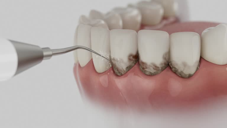 Reliable Dental contractor in Hutchinson Island South, FL by Dentist Open Now